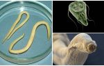 Comparaison de Giardia et Worms